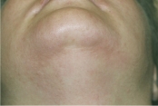 Undershot of a man's smooth chin after hair removal